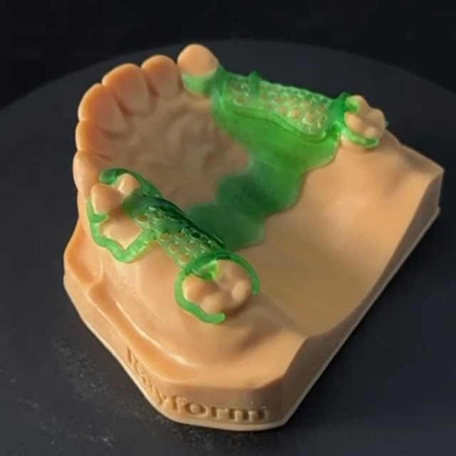 3D High-Precision Dental Casting Resin High-Wax Dental Castable Resin Compatible with 408nm 3D LCD Printers Dental Laboratories