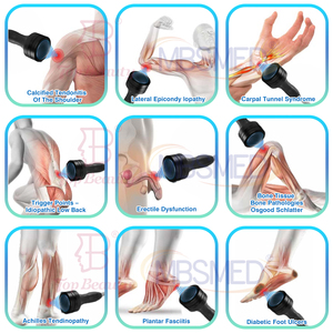 Focused Soft Shockwave Eswt Ondas De Choque Focales Shock Wave Ed Equipo de fisioterapia para disfunción eréctil - Product Image 5