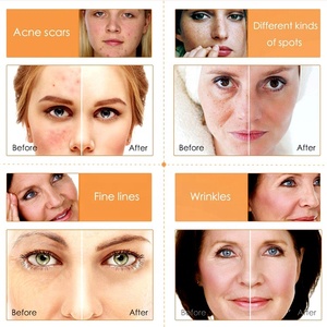 เซรั่มวิตามินซีชะลอวัยลดริ้วรอยจุดสว่างตอนเช้ามอยส์เจอร์ไรเซอร์ทำให้ผิวขาวติดป้ายตามต้องการ - Product Image 3