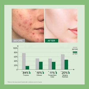 Crema all'ingrosso per cicatrici da acne, formula personalizzata, crema anti-acne per uomo e donna, leggera, delicata, controllo dell'olio, crema per acne infiammata - Product Image 6