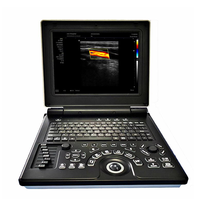 MN-E20 Hospital Medical 3D Laptop Ultrasound Machine Full Digital Ultrasound Scanner with Multi-language