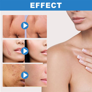 Jaysuing-<span class=keywords><strong>Gel</strong></span> cicatriciel avancé en <span class=keywords><strong>silicone</strong></span> pour cicatrices post-chirurgie - Product Image 4