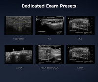 Sonde d'échographie Doppler couleur sans fil Yonker pour la médecine esthétique, la direction des injections faciales, la dermatologie et les cliniques de beauté