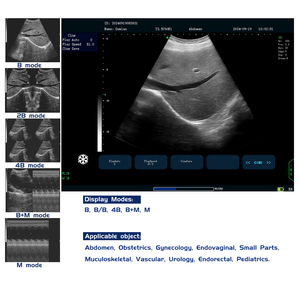 Les animaux de plate-forme PC utilisent une machine de balayage ultra sonore entièrement numérique portable à ultrasons de 15 pouces pour l'homme avec sonde convexe - Product Image 6