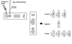 <strong>Malaria</strong> Pv/Pf Diagnostic <strong>Kit</strong>(WB) POCT <strong>Malaria</strong> <strong>Test</strong> for Field Screening - Product Image 3