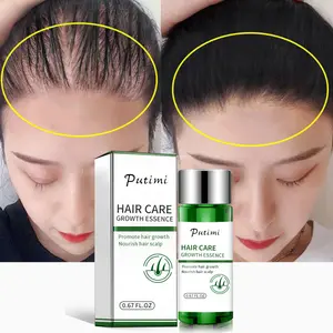 Putimi Natural Plant Women Men Treatment Hair Loss Oil Hair Serum Growth Anti Hair Loss Serum