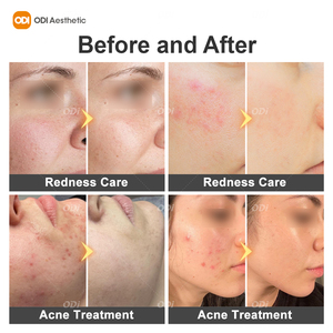 Appareil de rajeunissement cutané et de lifting facial triple multifréquence (1 MHz, 3 MHz, 10 MHz) pour le soin et le refroidissement de la peau - Product Image 6
