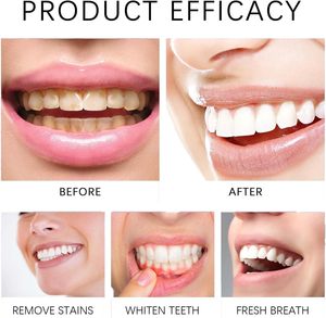 Disposable Wipe Oral Finger Brush Up Fast Stain Removal <b>Teeth</b> <b>Cleaning</b> <b>Tool</b> Portable Soft Gentle Toothbrush Non-Sensitive Wipe - Product Image 5
