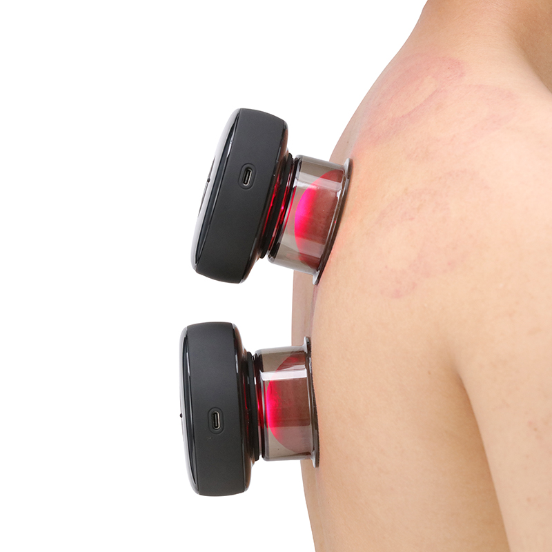 Электрическое баночное устройство, баночки с красным светом, многофункциональная терапевтическая чашка, массажные Баночки, терапевтическая вакуумная терапевтическая машина