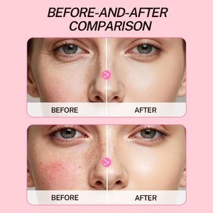 OEM ODM Lightweight Natural Dual Chamber Face Gel Cream Skin Intensive Hydration Moisture Whitening Face Care Best Skin Care Set - Product Image 6