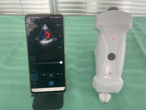 उच्च गुणवत्ता वाले पोर्टेबल अल्ट्रासाउंड डिजिटल वायरलेस हैंडहेल्ड अल्ट्रासाउंड मशीन डॉक्टर के उपयोग के लिए - Product Image 5