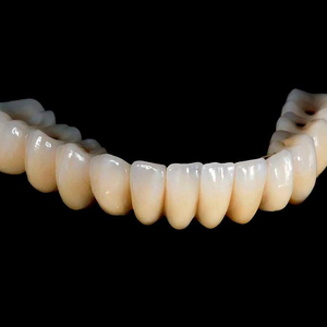 Giá Rẻ Giá In 3d Nha Khoa Bảo Vệ Mô Hình Dịch Vụ SLA SLS 3d Máy In Nhà Máy Cung Cấp Các Bộ Phận Y Tế 3d In Ấn Nhà Sản Xuất - Product Image 4