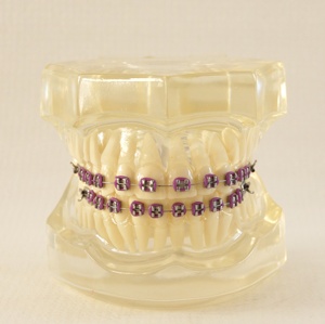 Dents dentaires orth modèles orthodontiques avec supports - Product Image 4