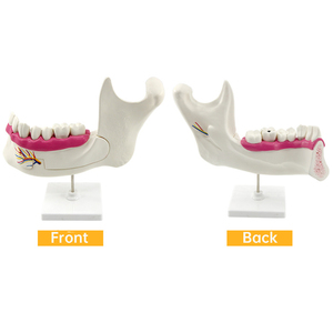 Modèle d'anatomie molaire et de prothèse dentaire <span class=keywords><strong>adulte</strong></span> SCIEDU pour les instruments d'enseignement de la biologie du lycée junior et senior modèles médicaux de dents - Product Image 4