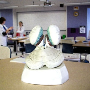 Modello Anatomico dell'Organo del Corpo Umano del Quarto Ventrice con Tessuto Coroidale e Plexo Coroidale per Formazione Medica - Product Image 3