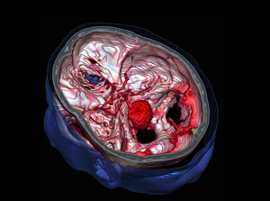 Scanner <span class=keywords><strong>CT</strong></span> spiralé vétérinaire remis à neuf, <span class=keywords><strong>prix</strong></span> du scanner <span class=keywords><strong>CT</strong></span> vétérinaire, clinique vétérinaire, scanner <span class=keywords><strong>CT</strong></span> à double tranche, équipement vétérinaire, scanner <span class=keywords><strong>CT</strong></span> d'occasion - Product Image 3