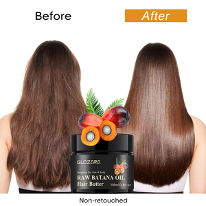 Proveedores de tratamientos capilares con aceite de Batana al por mayor, aceite para el crecimiento del cabello de marca privada para peinado. - Product Image 2