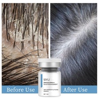 Salon professionnel de soins capillaires Ampollas Para El Cabello pour le traitement antipelliculaire Ensemble d'ampoules d'essence antipelliculaires de 5ml