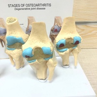 Haute qualité d'enseignement médical modèle d'anatomie Humaine stades de l'arthrose