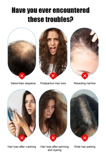 เครื่องวิเคราะห์เส้นผม 5in1 สำหรับดูแลหนังศีรษะและกระตุ้นการเจริญเติบโตของเส้นผม พร้อมสเปรย์นวดความถี่สูง - Product Image 4