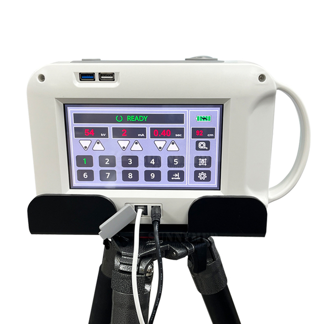 SY-D034 Portable Digital X-ray Machine X-Ray Equipment for Human and Animal Use