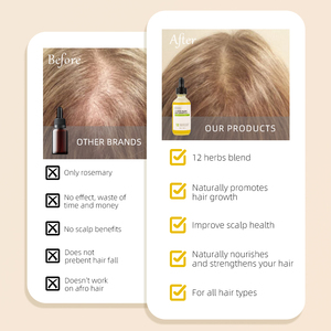 Huile Naturelle pour la <span class=keywords><strong>Repousse</strong></span> des Cheveux, Sérum Épaississant, Essence de Croissance Capillaire Fortifiante aux Herbes, Huile de Romarin Nourrissante pour le Cuir Chevelu - Product Image 6