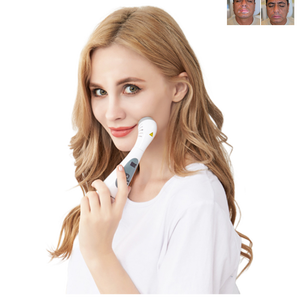 Mesin terapi cahaya UVB LED 308nm, fototerapi rumah untuk perawatan penyakit Vitiligo - Product Image 4