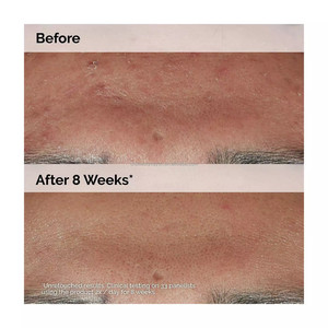 Vente chaude 30ml Niacinamide 10% + Zinc 1% sérum pour le visage pour les soins de la peau réducteur de pores contrôle de l'huile éclaircir la peau - Product Image 5