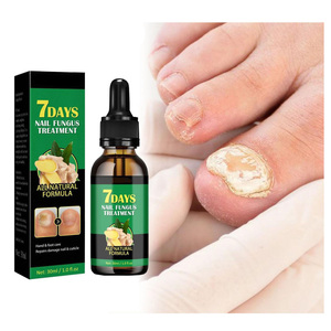 Solución para el Cuidado de Manos y Pies con Jengibre OEM para Dropshipping, Fortalece las Uñas e Hidrata la Piel - Product Image 2