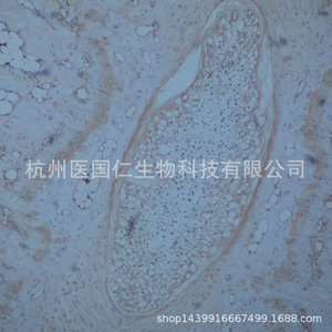 Immunohistochemistry Tissue Sample Pathology Service Paraffin Sections Cell Slides Frozen Sections Biotechnology Lab Reports - Product Image 2