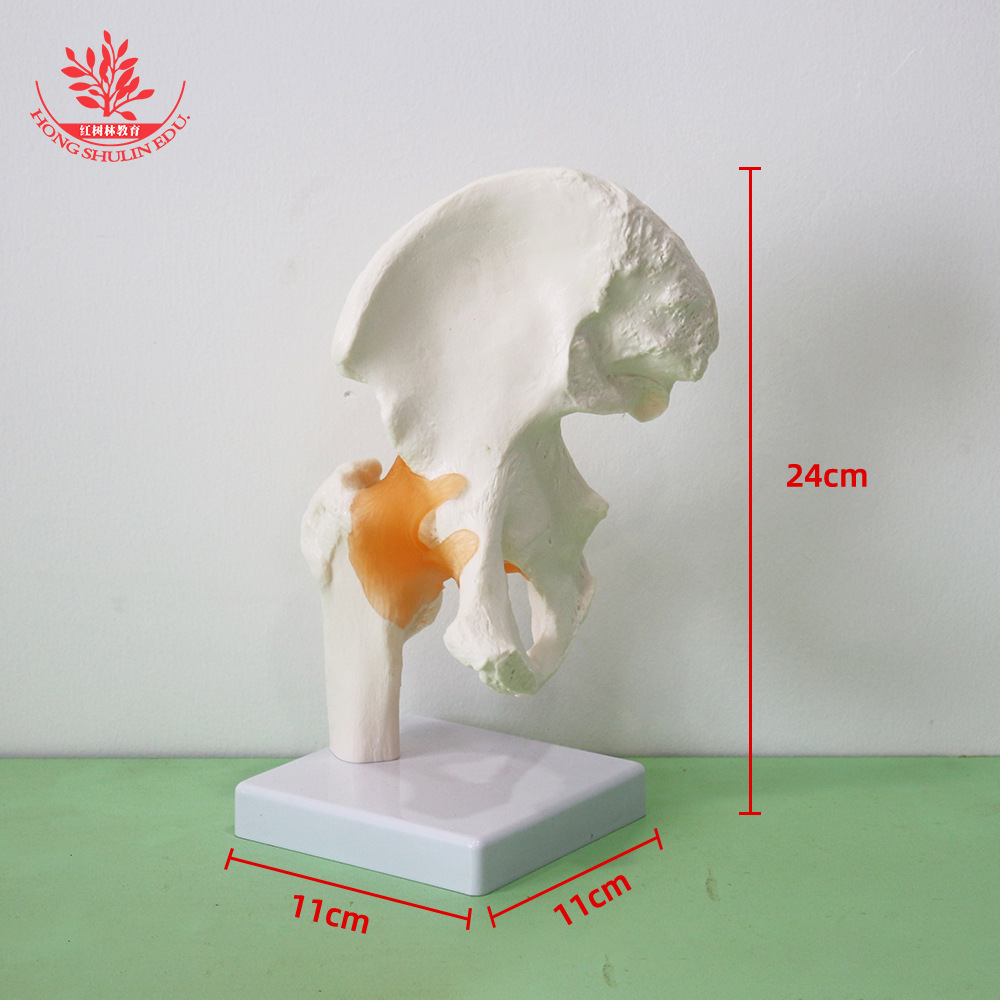 Hip joint
