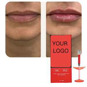 Filler Labbra Rosso da 1ml con Vitamina B12 e <span class=keywords><strong>Acido</strong></span> <span class=keywords><strong>Ialuronico</strong></span> per Labbra Naturalmente Morbide, Voluminose e Luminose - Product Image 1