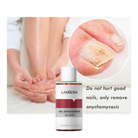 LANBENA Traitement Efficace des Ongles, Solution Réparatrice Anti-fongique
