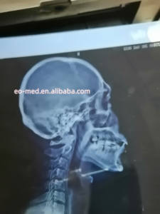 Beaucoup de conception intelligente d'imprimante à jet d'encre de film radiographique d'innovation avec l'encre noire double de type indépendant de 5 couleurs XP02 - Product Image 6