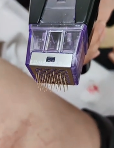 Máy trị mụn bằng tần số vô tuyến phân đoạn, làm săn chắc da, nâng cơ mặt, máy trị liệu da mặt <span class=keywords><strong>Morph</strong></span> 8 - Product Image 3