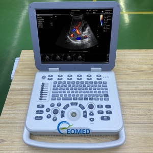 Escáner de Ultrasonido Canino y Felino CU30-2, Doppler Color Portátil para Veterinaria, Cardiología, Obstetricia, Abdomen, Vasos, Clínica, CU30-2vet - Product Image 4