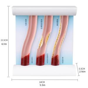 PVC人体动态高脂血症血管堵塞模型中血液稠度流的演示与比较 - Product Image 2