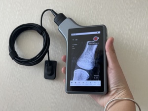 Sensor RVG Todo en Uno con Pantalla para Diagnóstico Inmediato de Caries, Periodontitis y Canal Radicular, Pantalla de Tableta con Sensor RVG Dental - Product Image 2