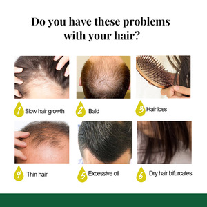 EELHOE <span class=keywords><strong>Olio</strong></span> Riparatore per Capelli al Ginger, Miscela di <span class=keywords><strong>Olio</strong></span> Germogliante allo Zenzero 7 Giorni, Miglior Spray per la Crescita dei Capelli per Donne - Product Image 3