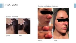 LED máy trị liệu bằng ánh sáng <span class=keywords><strong>PDT</strong></span> LED máy trị liệu bằng ánh sáng LED cho mặt <span class=keywords><strong>PDT</strong></span> - Product Image 2