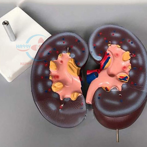 Modèle pédagogique de l'anatomie du rein humain HC-S266, structure rénale - Product Image 3