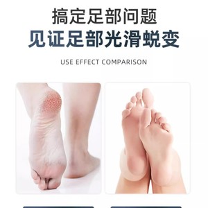 Factory direct wholesale of new foot scrubbers, calluse removers, and double-sided stainless steel foot scrapers. - Product Image 4