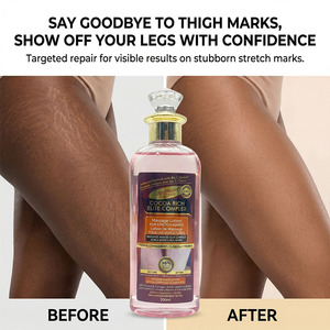 Minyak Tubuh Gluta Master Stretch Mark Formula Alami Bernutrisi Melembapkan Secara Mendalam Meningkatkan Elastisitas Memudarkan Bekas Kehamilan 200ml - Product Image 2