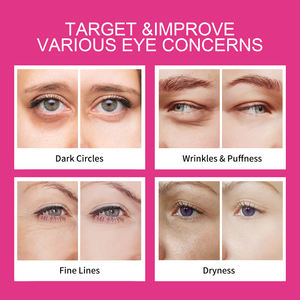 OEM Crème yeux blanchissante active de haute qualité biologique Crème Blanchissante Contour des Yeux pour peaux sensibles Filtre UV Fade Spot - Product Image 2