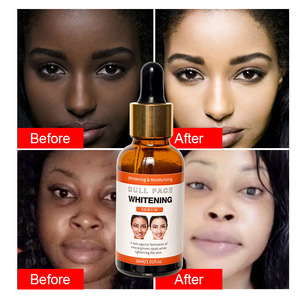 Siero Viso Naturale Anti-Età e Sbiancante con Serotonina, Arbutina, Oli Essenziali, Aloe Vera, Lenitivo per Uso Domestico Femminile - Product Image 1