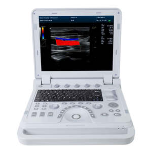 Precio del Sistema de Ultrasonido CONTEC CMS1700A, Máquina de Ecocardiografía - Product Image 1