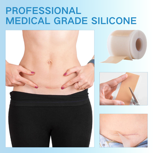 Fita de Silicone Médica Profissional para Cicatrizes, Estrias e Remoção de Protuberâncias, Atacado a Granel - Product Image 5
