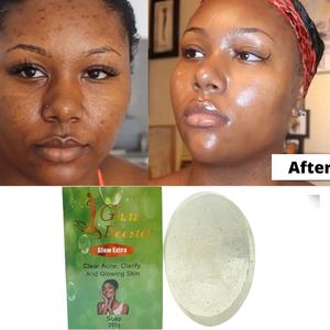ฉลากส่วนตัวผลิตภัณฑ์ดูแลผิวขายส่งสบู่ล้างสิวล้างเปล่งปลั่งผิวทำความสะอาดบาร์จุดด่างดำ Remover สำหรับผิวแอฟริกัน - Product Image 3