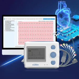 Viatom th12 máquina de cabo de 12 canais, portátil, mini monitor de suporte, gravador, 12 chumbo, cardioline ecg, eletrocardiogafia