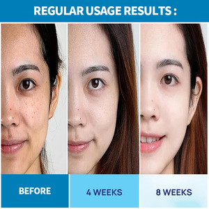 Suero Reductor de Poros AFCARE con Ácido Lactobiónico, Cuidado de la Piel, Esencia Facial, Cierra los Poros, Alivia la Sequedad, Hidrata - Product Image 5